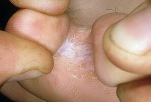 Terapia ludzi